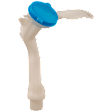 Washer Reservoir Filler Neck, with Cap, Sedan